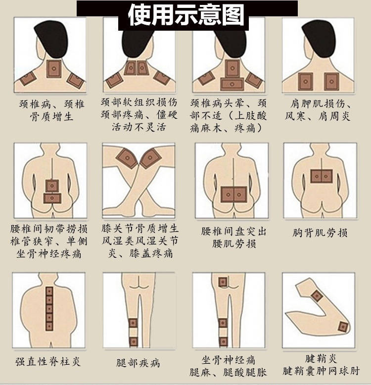 姜贴生姜贴驱寒发热防寒贴驱寒祛湿姜贴生姜热疗贴颈椎贴风湿关节膏贴