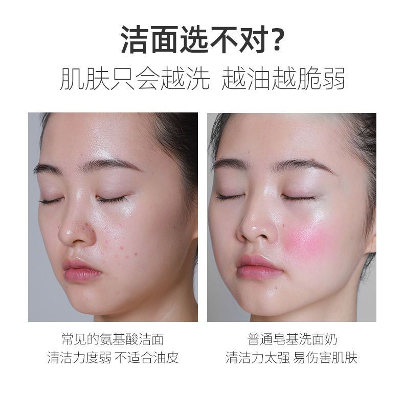 舍曼紫苏氨基酸洗面奶女控油祛痘学生洁面乳深层清洁收缩毛孔两瓶装值