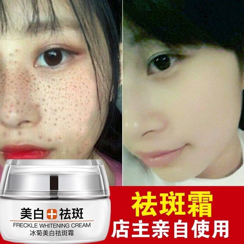 索芙特美冰菊霜美白淡化面膜女黄褐雀斑套装早晚学生白霜