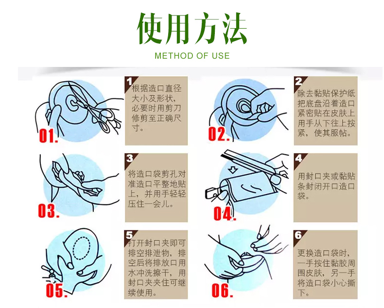 康乐保(coloplast)一件式造口袋胜舒15251肠造口袋造