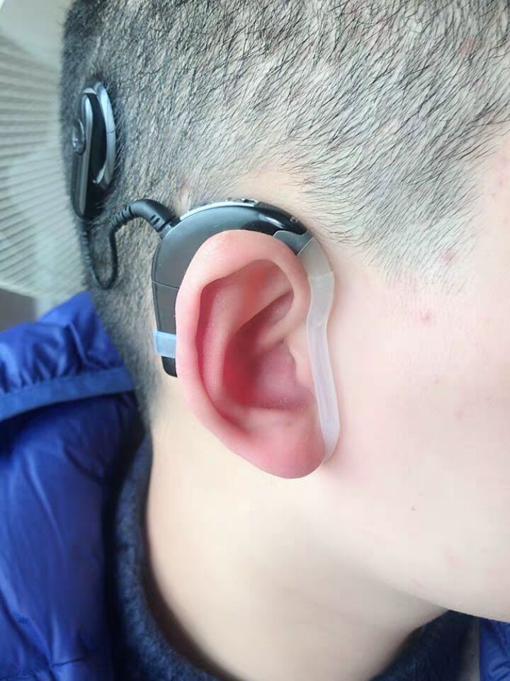 澳大利亚人工耳蜗n5配件n6n7处理器防汗套线圈套耳锁n5810黑色处理器