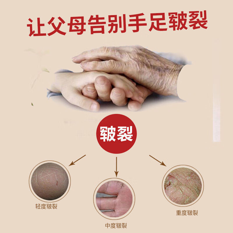 睫蓓精品国货 青岛塑铁马牌润面油保湿防干裂马油口子油棒棒油护手霜 1支装【普通款