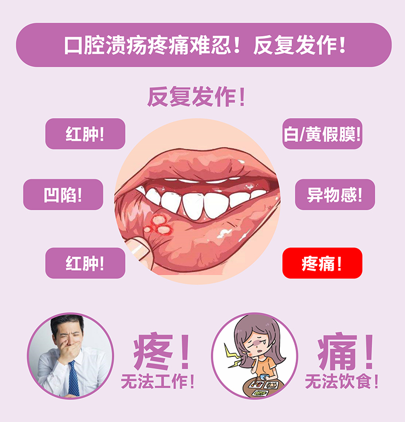 宁之助曲安奈德口腔软膏5g复发性口腔溃疡牙龈炎口腔黏膜急慢性炎症5支+ 