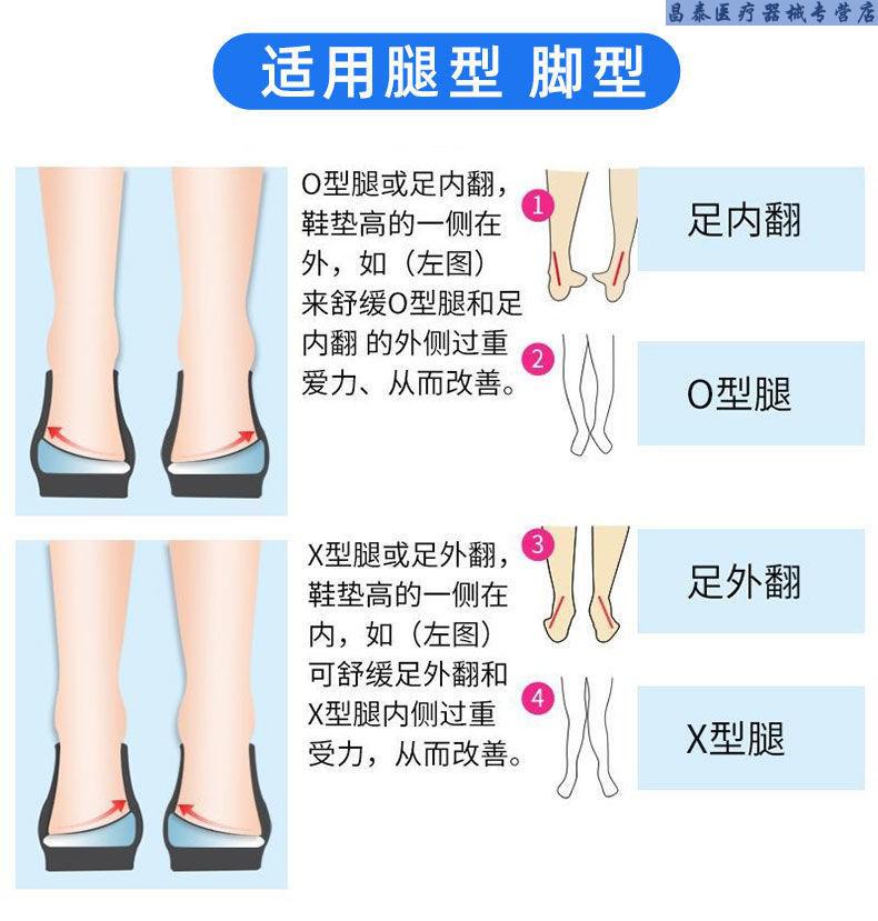 o型腿鞋垫外翻足内翻x纠正器内外八字儿童腿型神器速效款双磁石外八字
