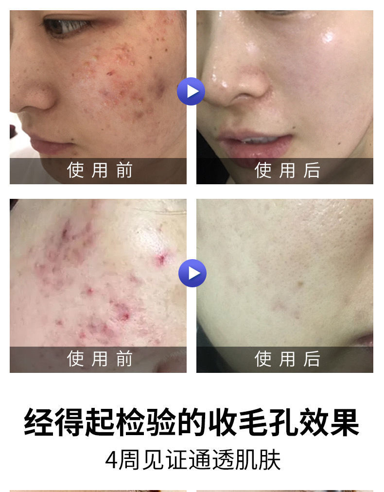 华南理工大学研发洗面奶韩鹭洗面奶水杨酸控油去豆洗面奶华南理工大学