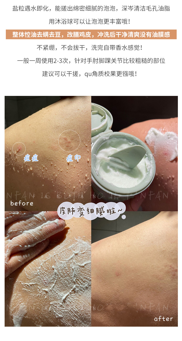 acemiss艾斯迷磨砂膏去鸡皮去角质身体脸面手部背部痘痘嫩白全身