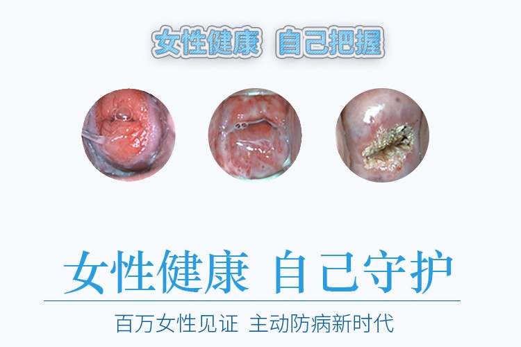 带灯带光源双翼扩张器妇科医用扩阴器检查透明扩宫器型窥阴器1个