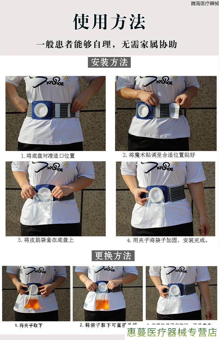 肠直肠癌改道造瘘造漏人工造口袋肛门二件式大便一次性腰带式腹带