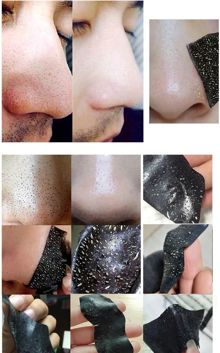 去黑头贴吸黑头神i器去粉刺鼻贴学生鼻头贴祛黑头螨虫收缩毛孔鼻贴5片