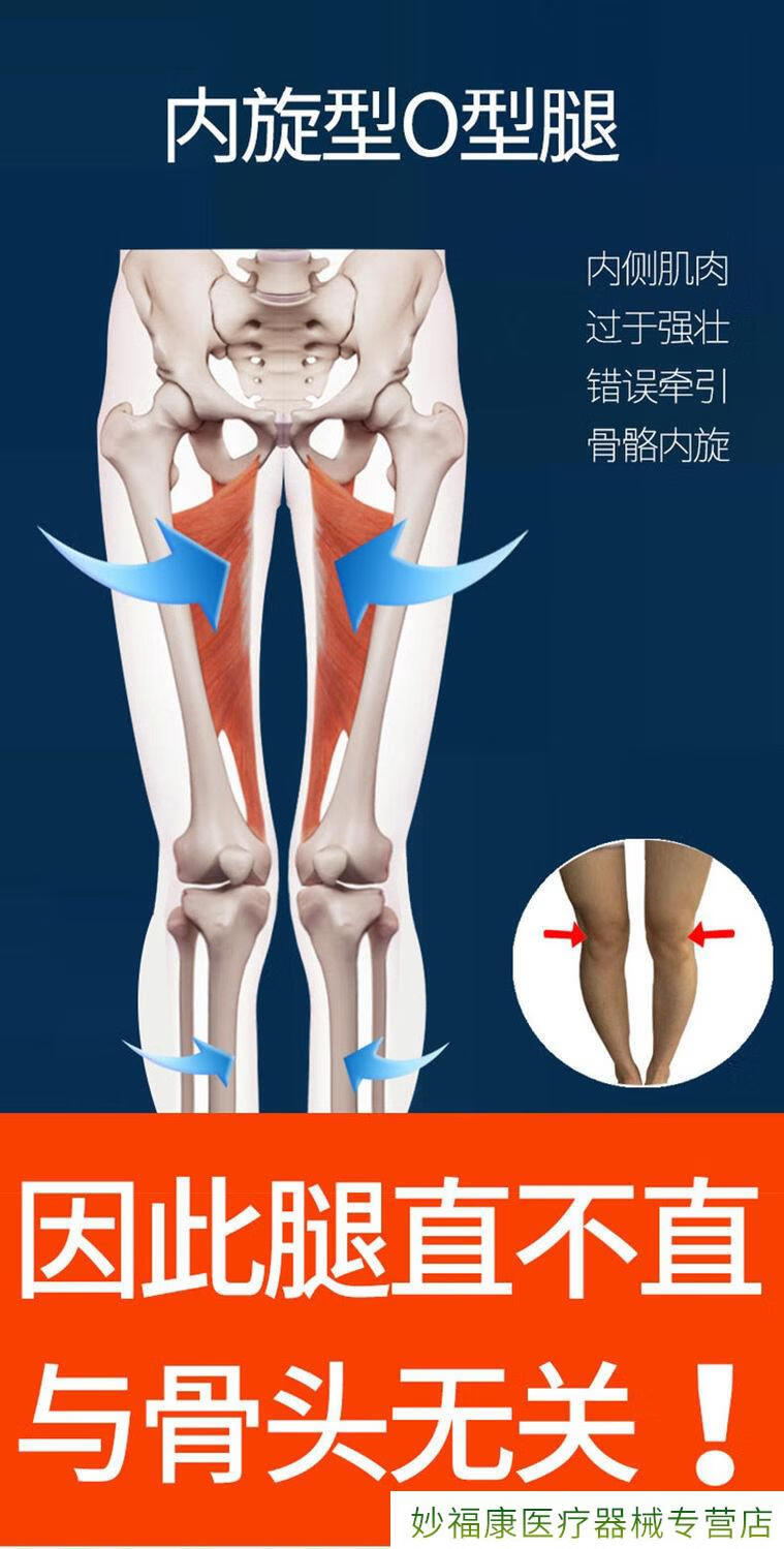 外翻内外八字腿型纠正神器 【第四代】ox型 成人大磁石款1双装【图片