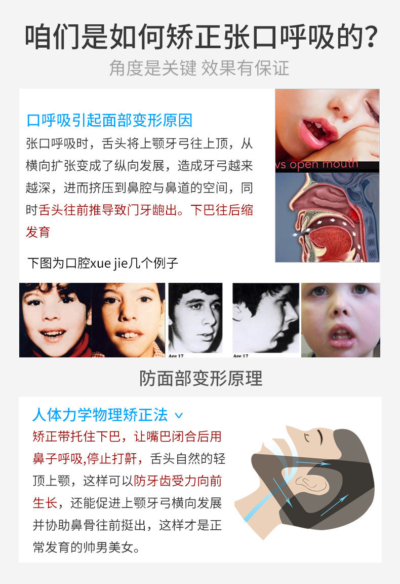 阙时翊口呼吸器闭嘴带睡觉嘴巴张口闭口儿童成人止鼾带口呼吸带口呼吸