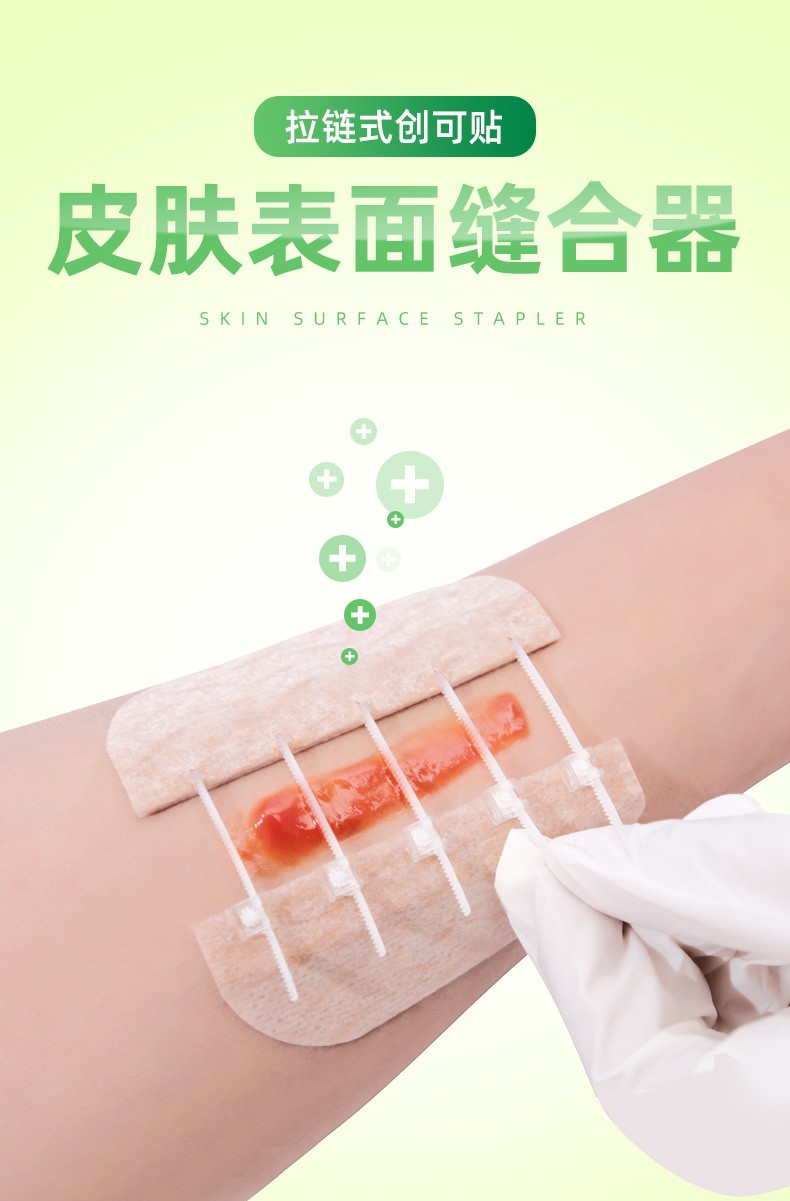 免缝合伤口贴拉链创可贴无痛缝合贴免缝针创口贴减张贴减张器伤口缝合
