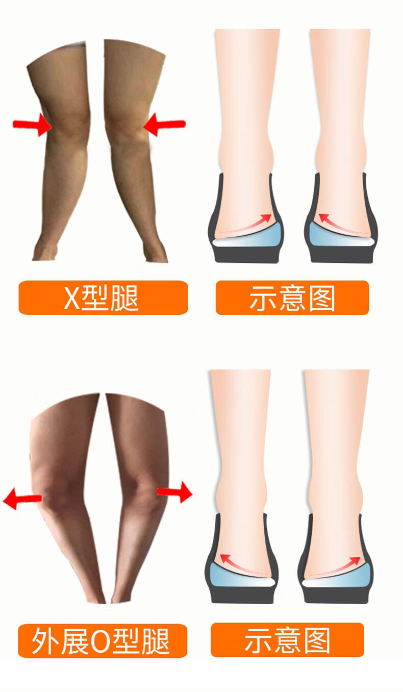 o型腿xo型腿内外八字足内外翻成人瘦腿减肥矫正足内翻火山大磁石2双装