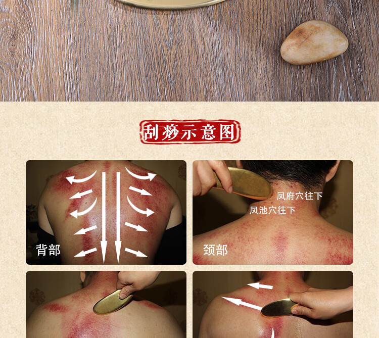 黄铜刮痧板问痧堂黄铜刮痧板虎符砭铜李道政李氏砭法全身通用铜刮痧