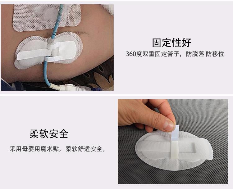 通用型体外导管固定贴导尿管引流管固定装置腹部穿刺管造瘘管贴定制5