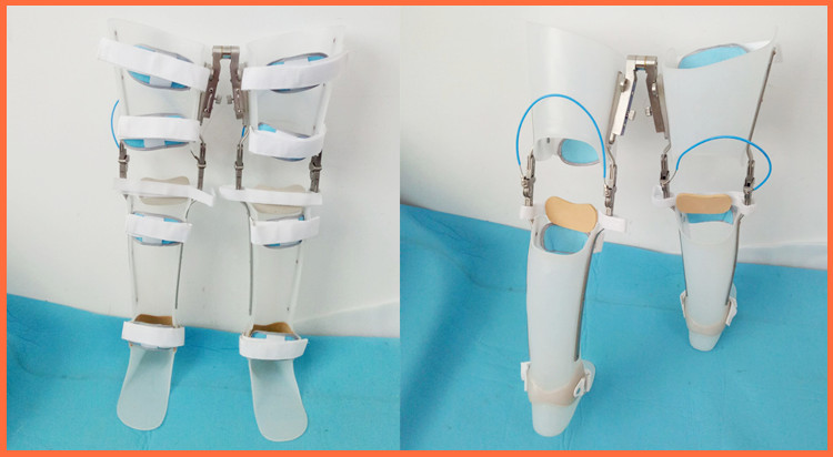 成人膝踝足中风偏瘫儿麻截瘫矫形器行走支具大腿矫形器定制落环锁右腿