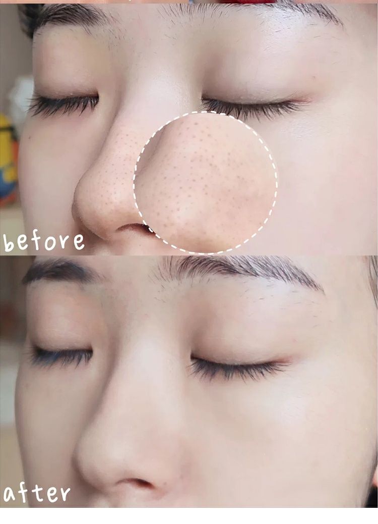 抖音直播带货樱花泥膜黑头粉刺学生女鼻膜清洁面膜嫩白补水毛孔清洁