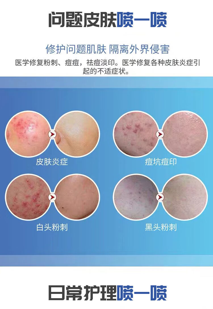 敷尔佳小喷雾透明质酸钠修复液大喷雾水光喷雾重组胶原蛋白 敷尔佳小