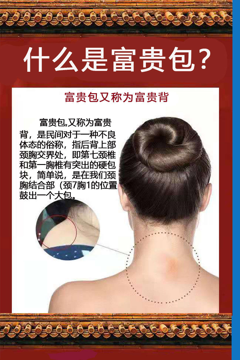 专i治颈部问题富贵包消散膏颈椎疼痛头l晕疏通颈部鼓