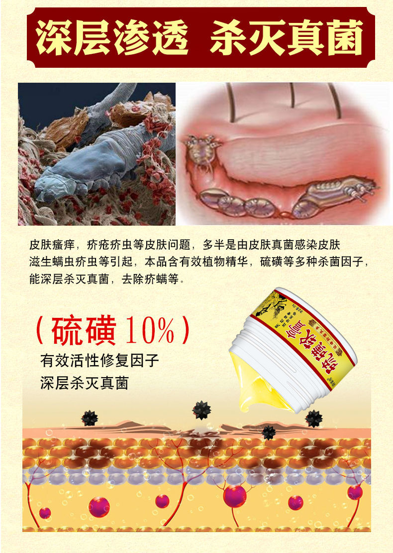 诗莱格硫磺软膏上海10硫磺乳膏外用结节阴虱疥虫皮肤瘙痒止痒买213盒