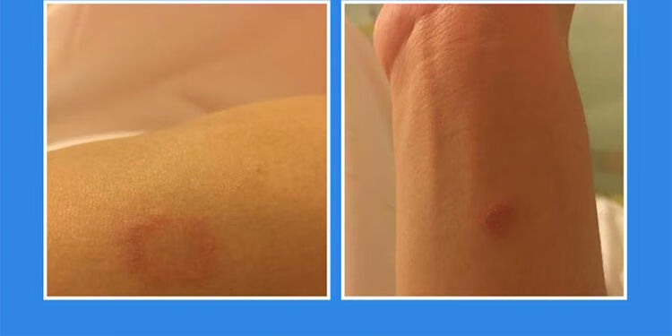 仓鼠驱虫药仓鼠体外驱虫药仓鼠除臭杀虫剂仓鼠荷兰猪皮肤病跳蚤药2