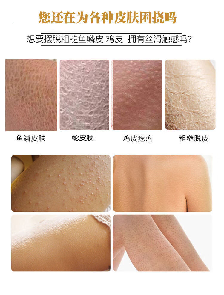 鱼鳞皮肤和鸡皮肤区别图片(鱼鳞皮肤和鸡皮肤区别图片大全)