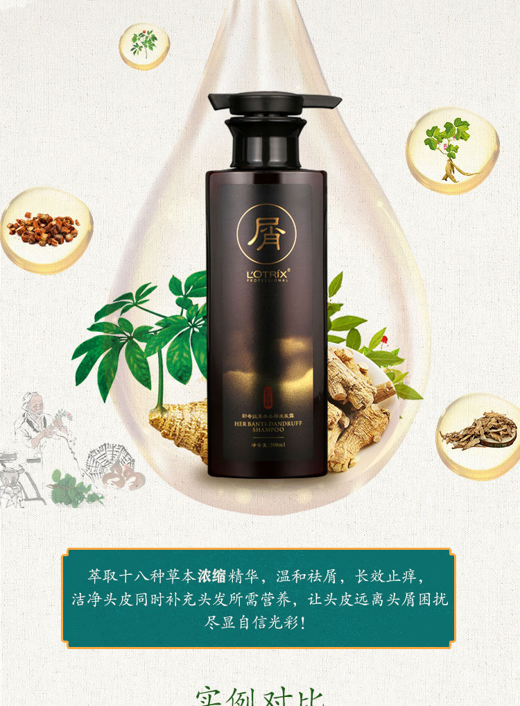 香港阿里郎洗发水 郎奇丝(lotrix)草本去屑止痒控油健发固根清爽无