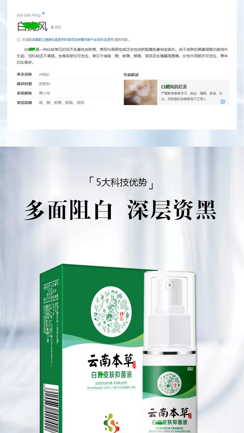 白癜风外用促补骨脂酊黑色素液喷剂誉芙美1瓶体验装