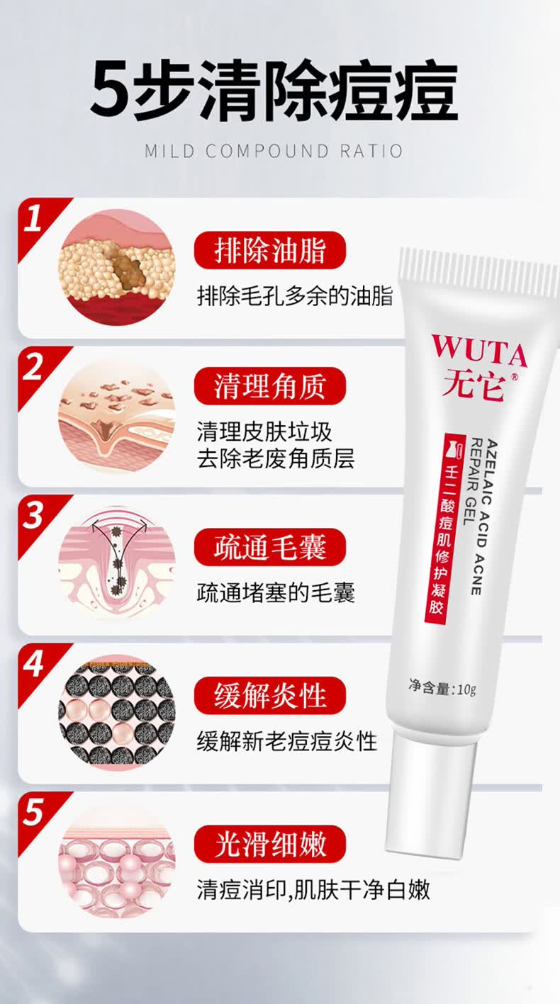 15%壬二酸祛痘膏凝胶修复壬二酸乳膏壬二酸15%针对玫瑰痤疮清爽消除