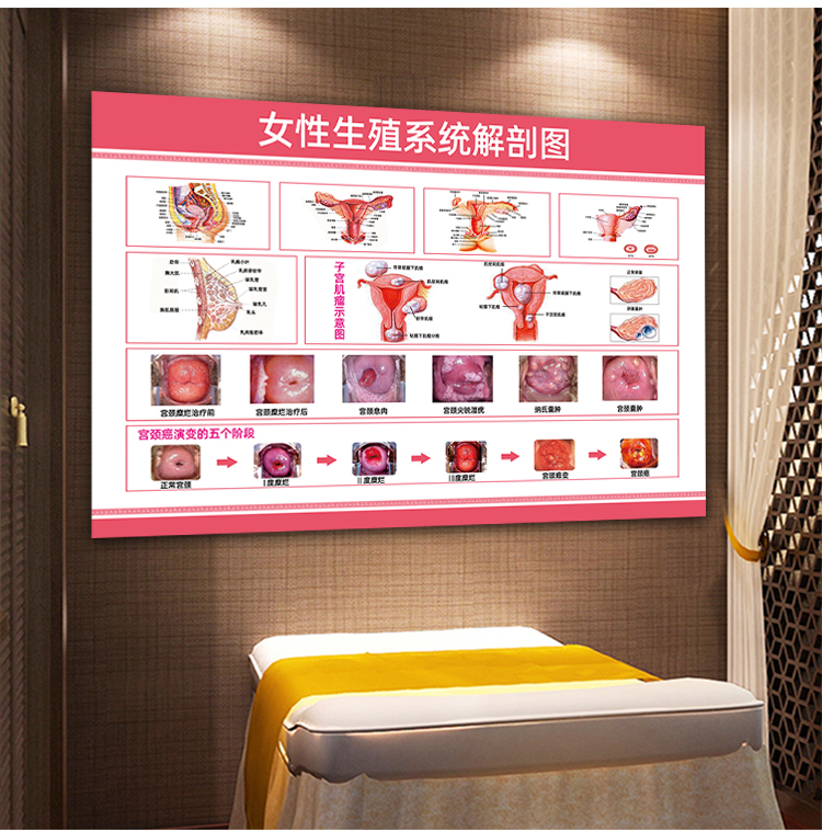 女性生殖器官图女性泌尿生殖解剖宫颈疾病示意图妇科人体器官挂图健康