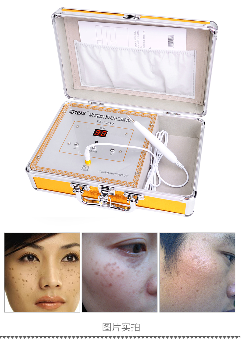 京健康美容院专用点痣笔仪器激光祛斑祛痣机器电离子取痣小白扫斑神器