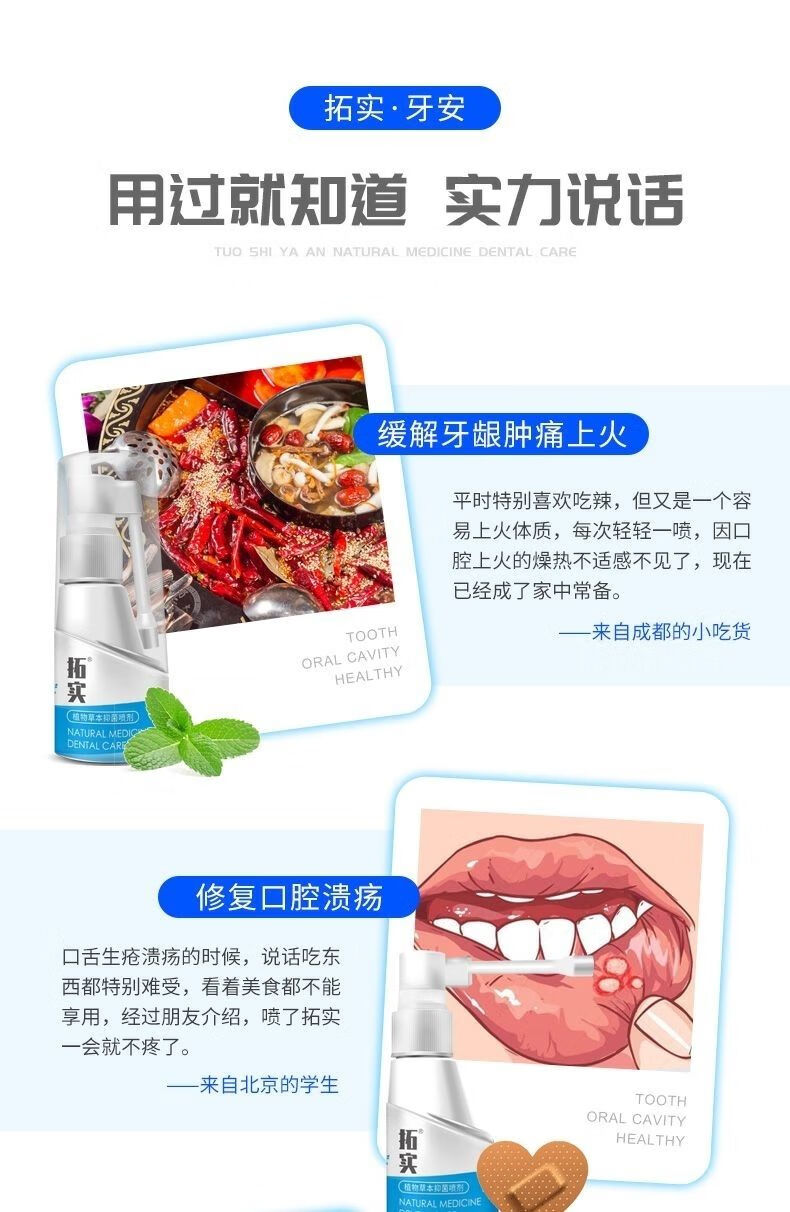 b型拓实喷剂蓝宝拓实牙安口喷牙疼牙痛牙龈肿喷雾剂牙舒牙2代拓实喷剂