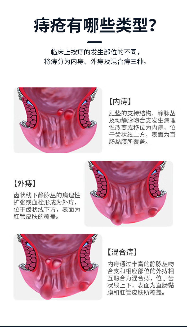 仁和化痔胶囊说明书图片