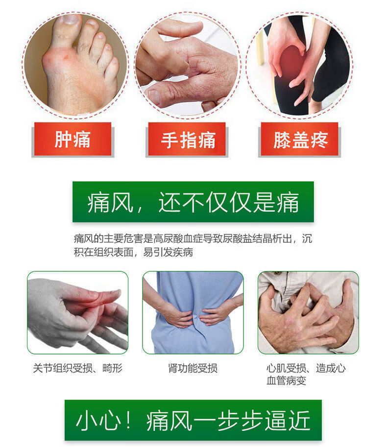囍成双痛风克星痛风膏消结晶脚趾关节红肿鼓包变形专用痛风克星痛风膏