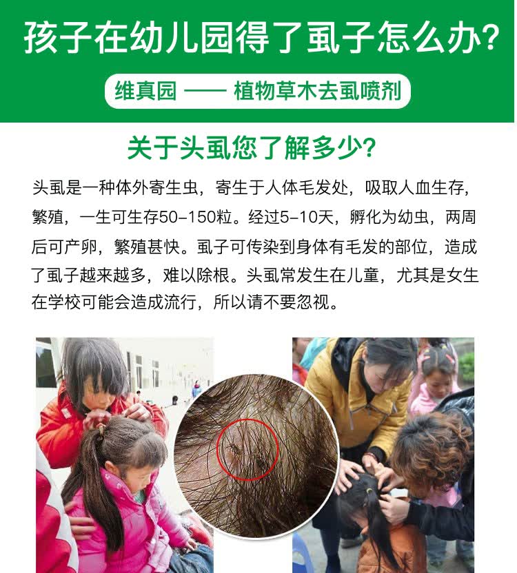 小孩子头上长虱子的药净去除虱卵儿童头上长虱子的药灭阴虱一扫光