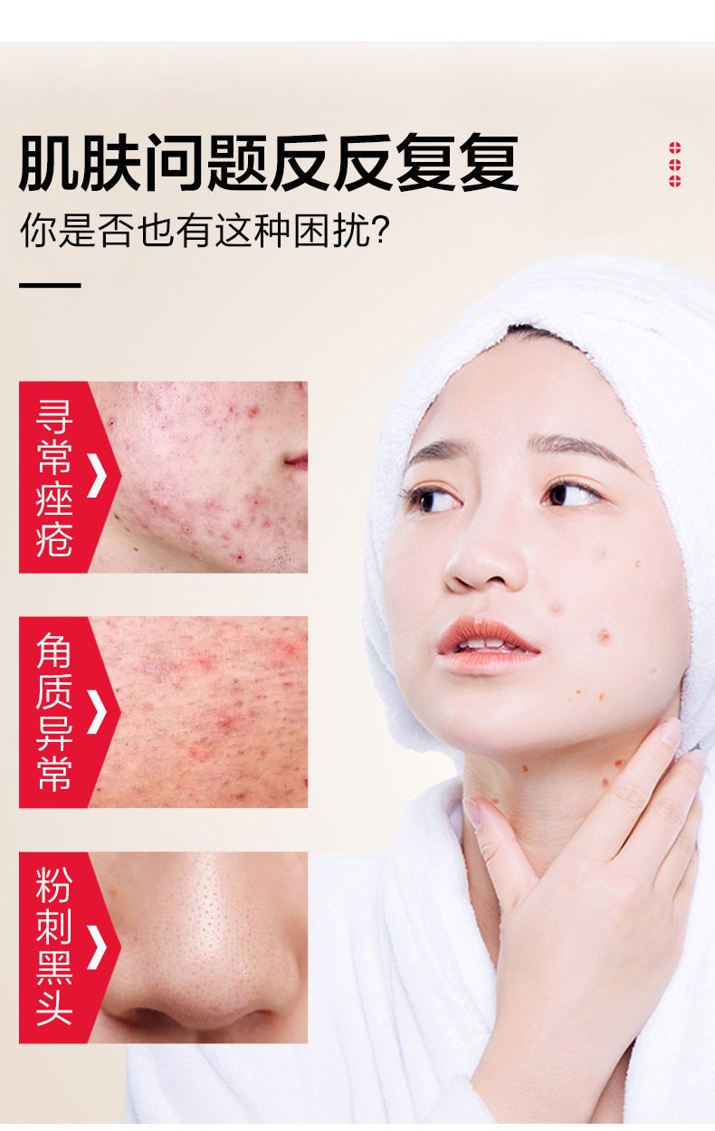维a酸乳膏 祛痘痘膏药去鸡皮肤银屑病毛囊角化疙瘩 扁平疣毛发红糠疹