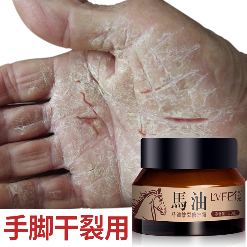 【有效去脚裂】马油手足皴裂膏 防裂膏去手裂 脚裂脚跟龟裂干裂开裂