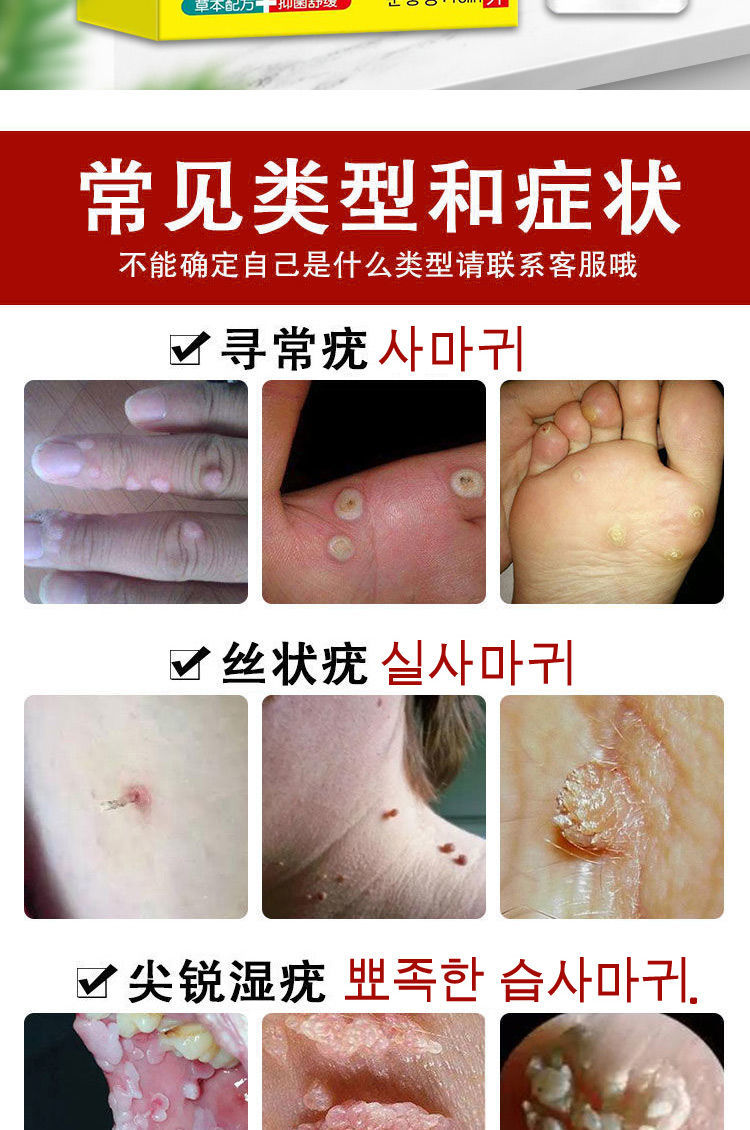 去脖子肉粒疙瘩l瘊l子神器去l丝l状l疣l嗖妤美鸦胆子祛l疣颈部刺瘊