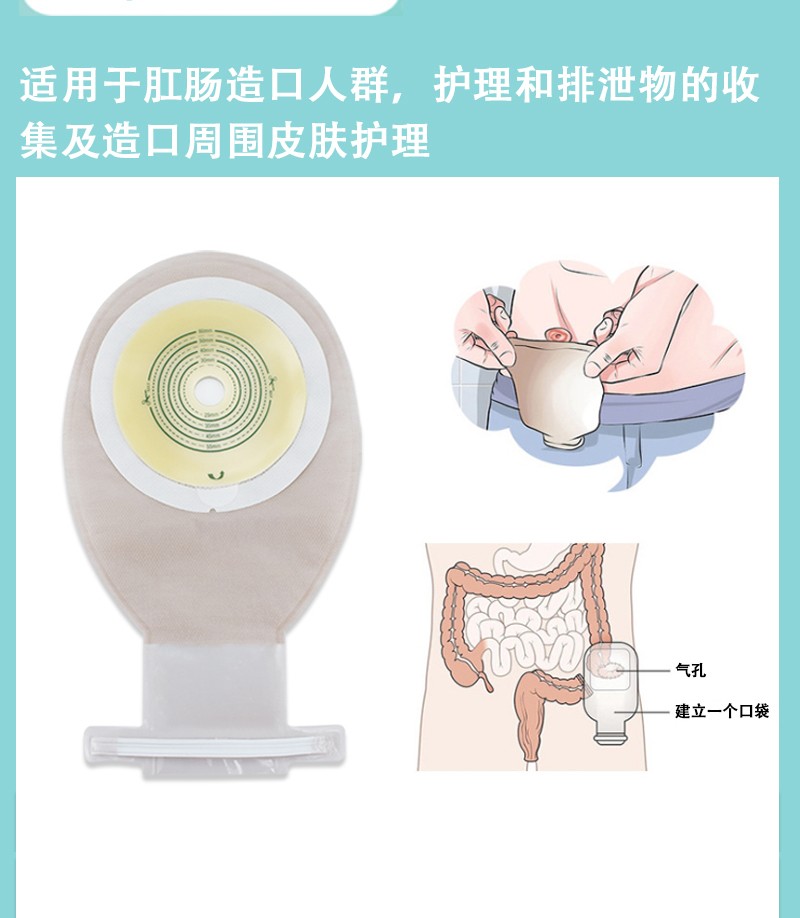 妥能 一件式肛肠造口袋造瘘袋开口 人工肛门袋大便造口护理用品 康wd