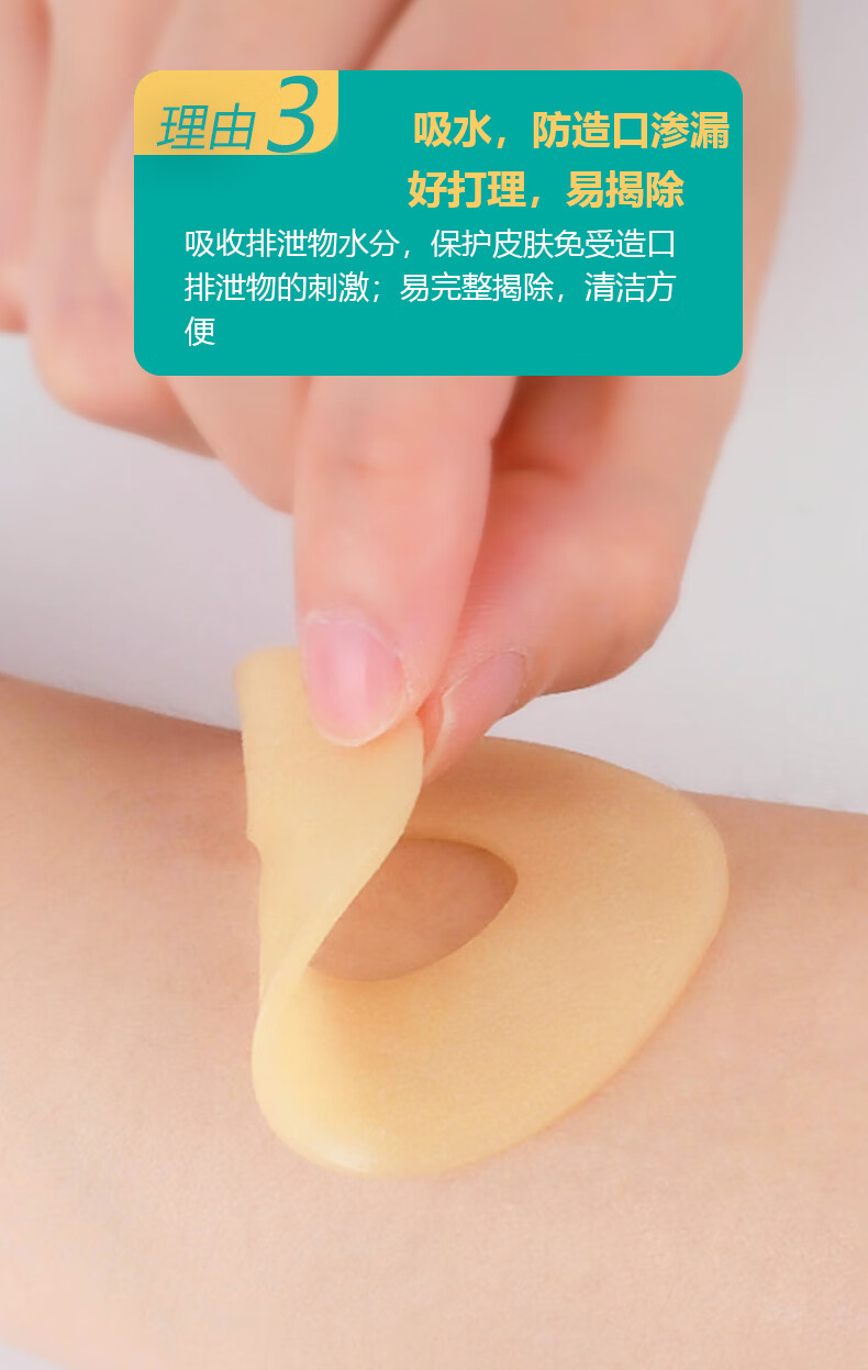 造口防漏贴环可塑形防漏圈造口袋护理用品附件防漏膏胶圈 试用装:2片