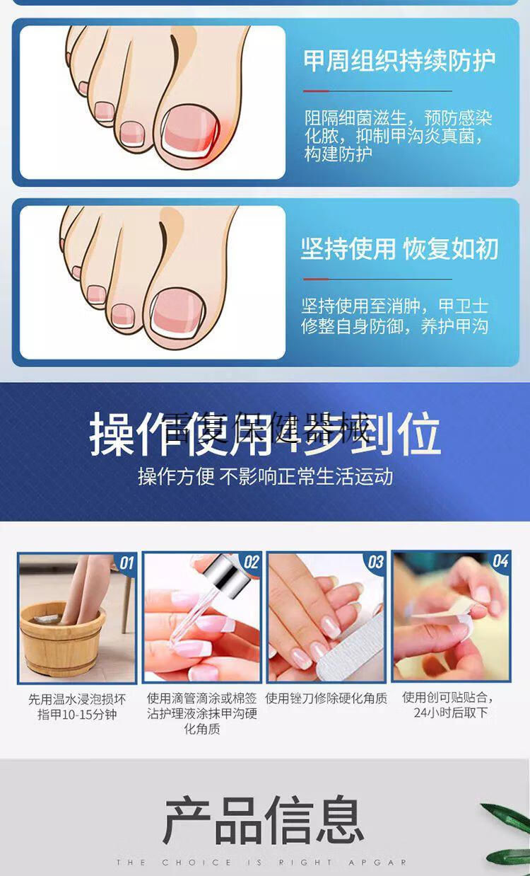 【jd健康】甲沟炎脚趾甲指甲嵌甲软甲神器肉芽发炎护理膏 【轻度