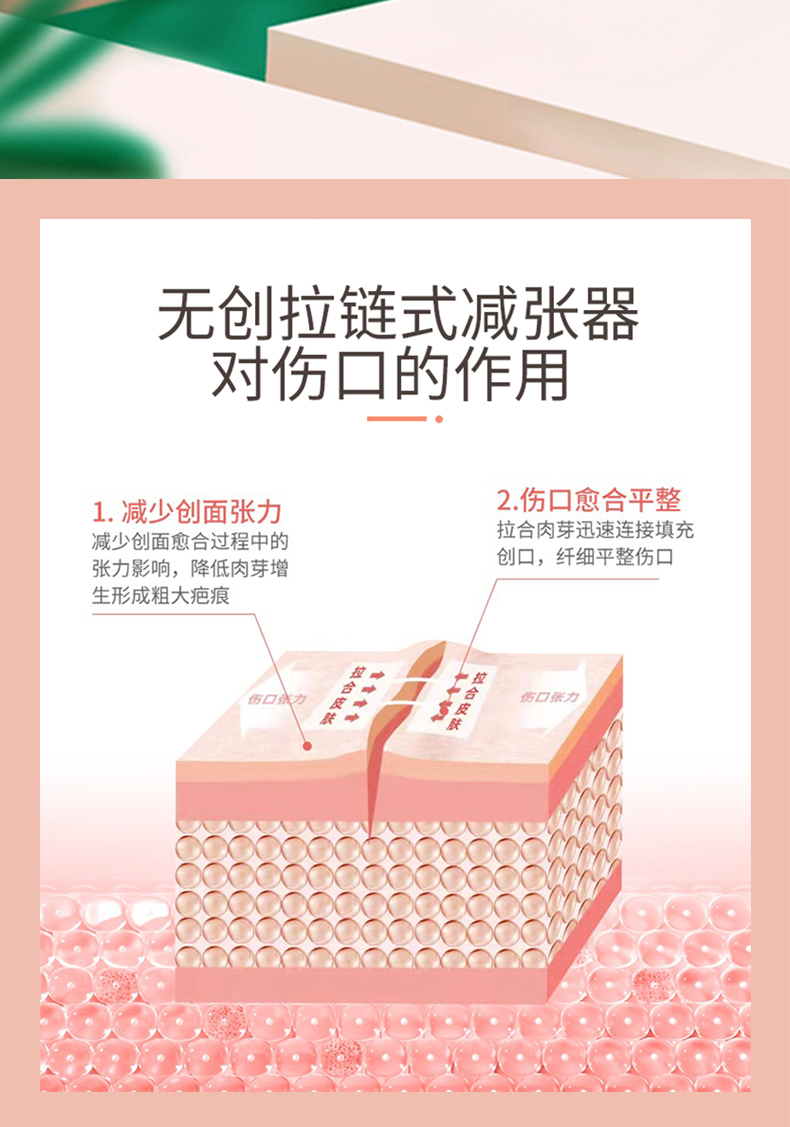 减张器 医用皮肤减张器免缝针疤痕伤口缝合拉合愈合儿童小号拉链式