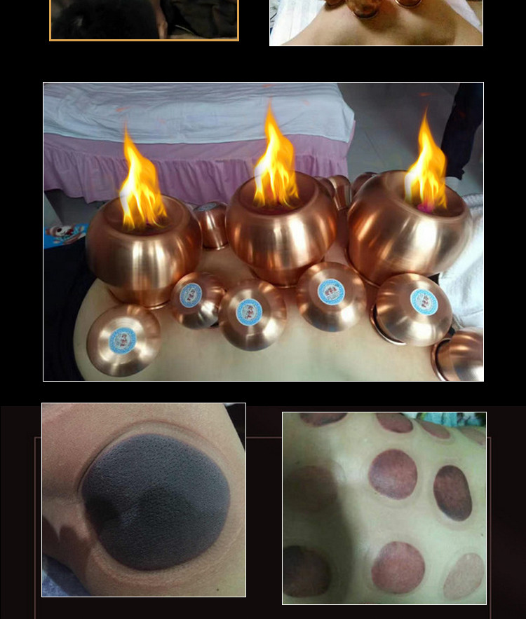 铜罐火罐拔罐器具老蒙医紫铜家用套抽气式火疗拔火罐工具巨罐arm 12个