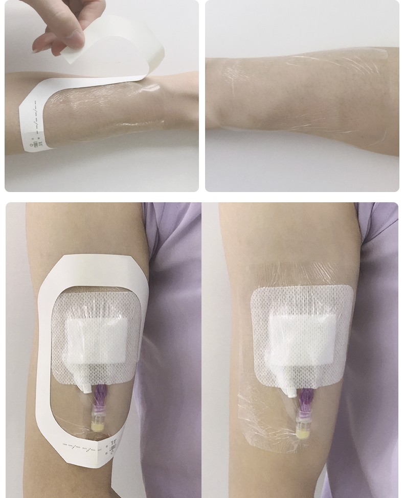 医用透明敷料贴防水贴一次性留置针贴膜picc静脉导管固定置管输液贴