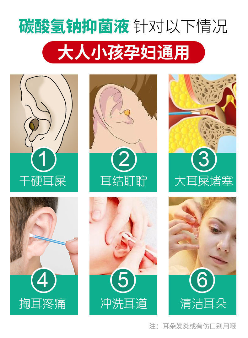 碳酸氢钠滴耳液人用耳朵结石清洁洗耳耵聍水儿童耳屎软化剂8发光镊