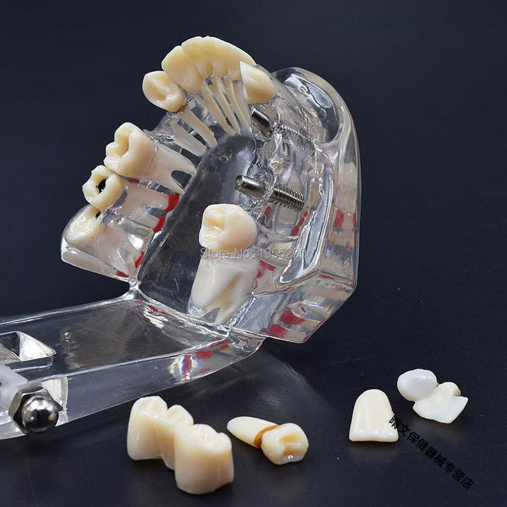 牙齿模型口腔教学模型种植模型正畸模型儿童早教刷牙模型牙科模型刷牙