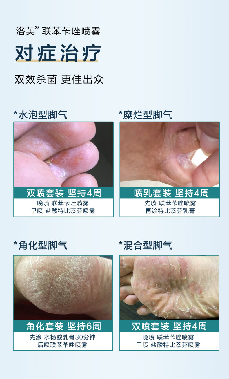洛芙 联苯苄唑喷雾 60ml 去脚气脚臭止痒脱皮烂脚丫真菌感染抑菌联苯