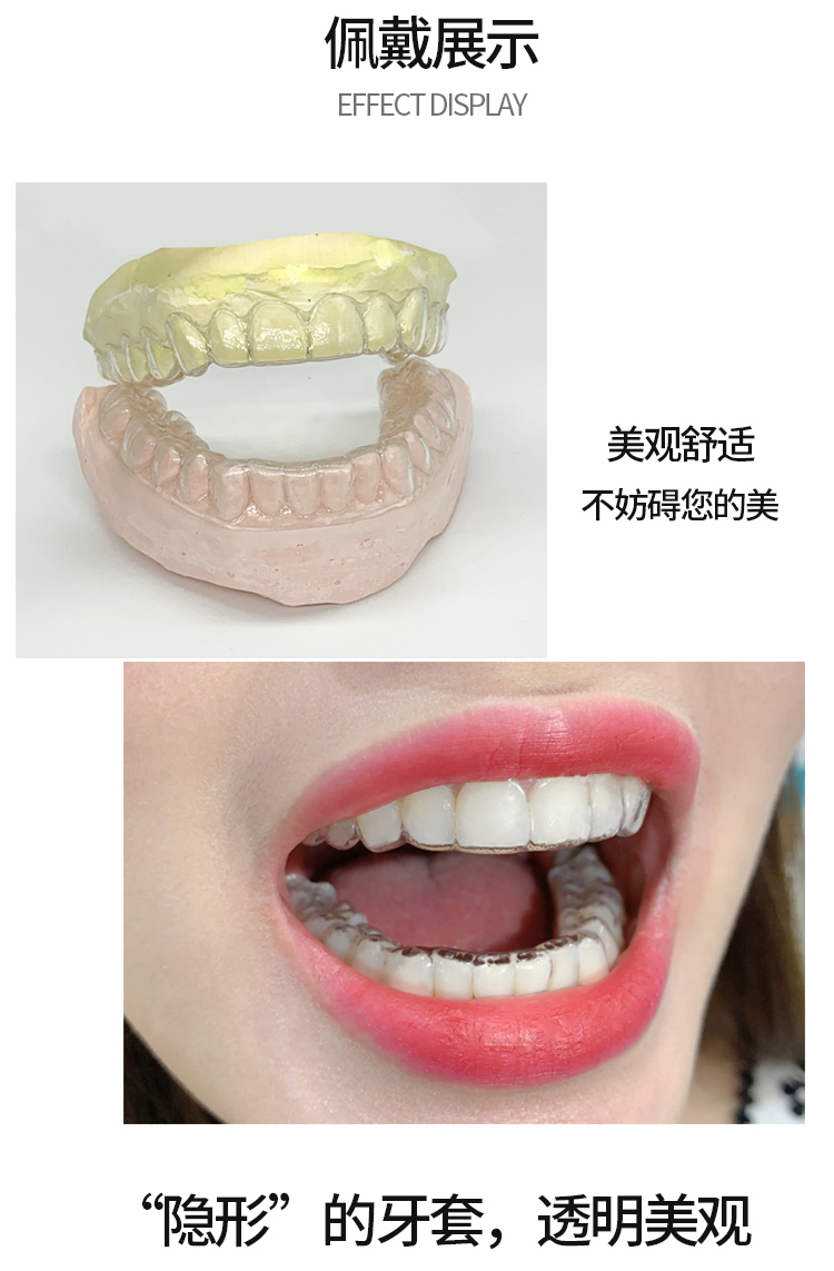 隐形牙套 定制透明保持器成人牙套隐形矫正压膜片大人儿童纠正牙齿