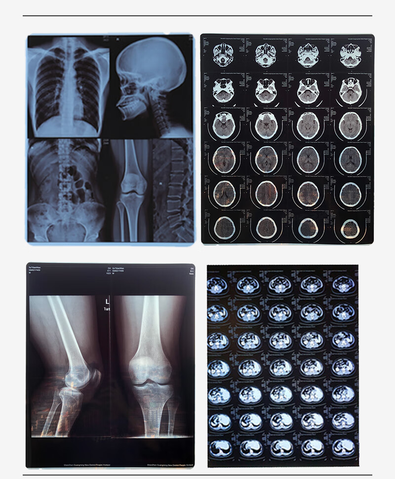 京健康 医院用干式喷墨高清放射胶片dr ct x光mr蓝片基核磁共振打印