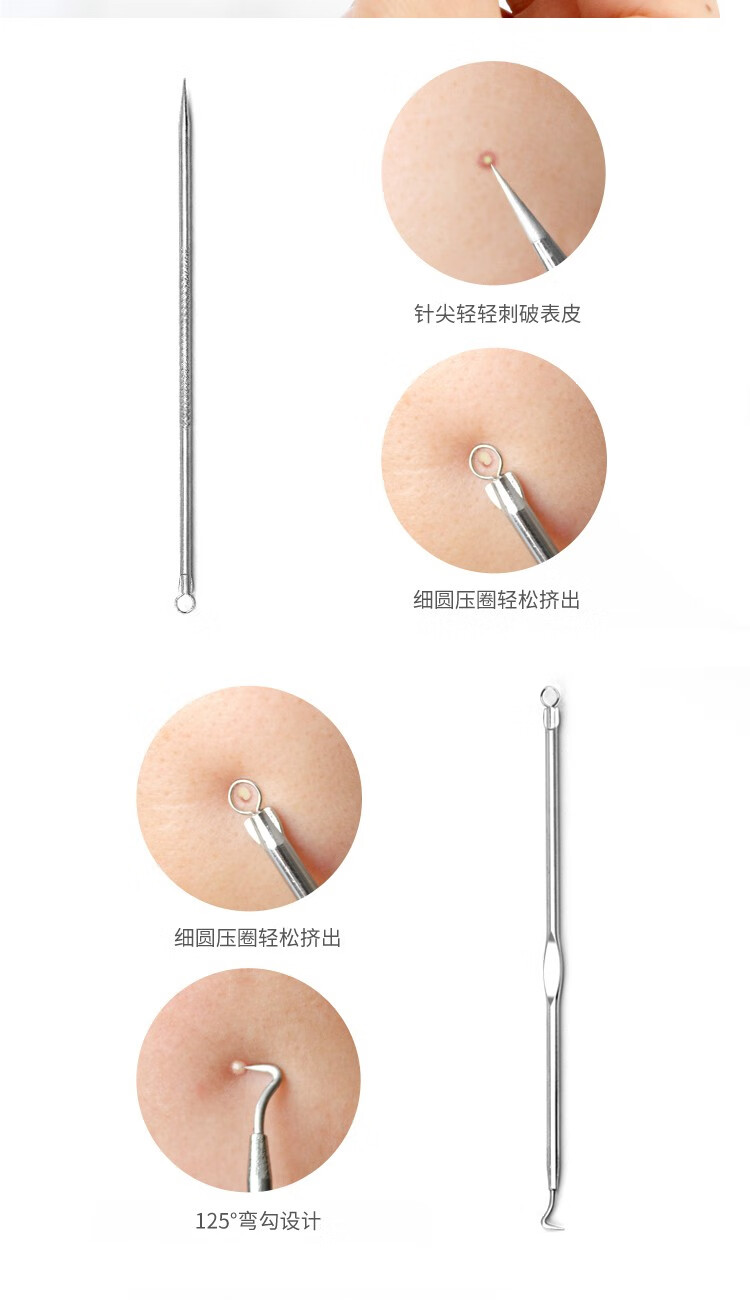 阿嚓热（ACARE）不锈钢粉刺针挤痘痘工具美容针暗疮针细胞夹套装家用 弯嘴夹+粉刺针+收纳盒
